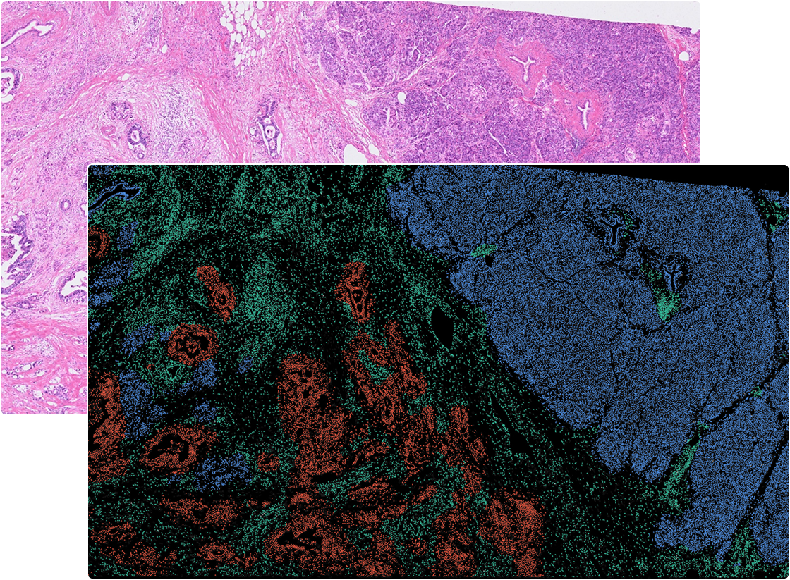 Tissue Segmentation in OmnibusX