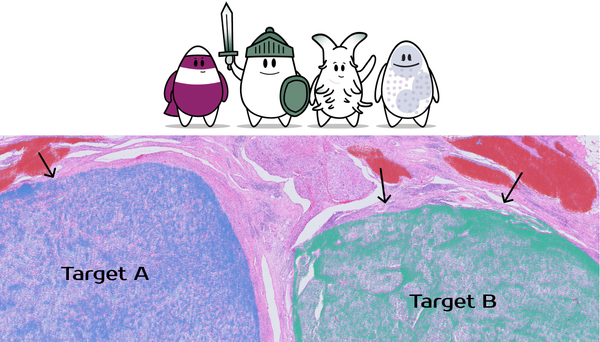 Analyzing Xenium In Situ Gene and Protein Expression Data with OmnibusX